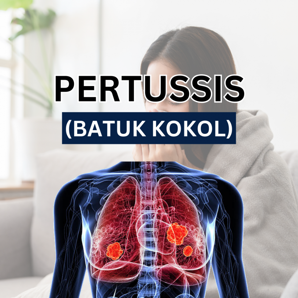 PERTUSSIS (BATUK KOKOL)