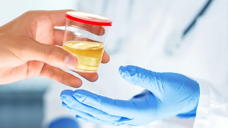 Urine Test /Pregnancy Test