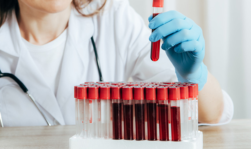 Biochemistry and Serological Blood Investigation