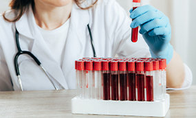 Biochemistry and Serological Blood Investigation