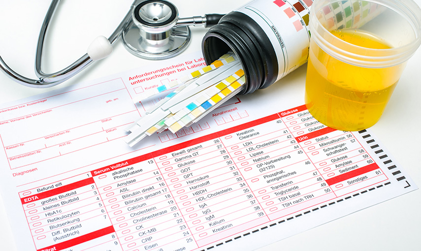 Urine Test / Pregnancy Test