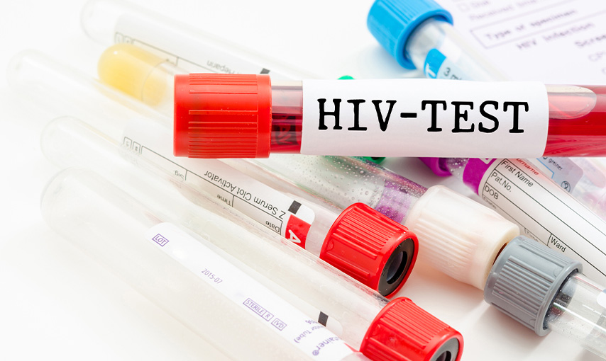 HIV and Sexually Transmitted Disease STD Screening