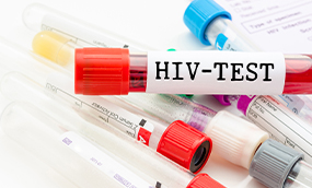 HIV and Sexually Transmitted Disease STD Screening