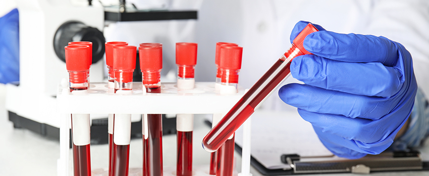 Precision in Haematological Testing