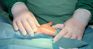 Hand & Microsurgery