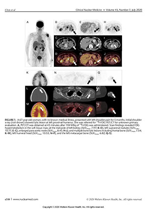 Ga-PSMA PET/CT and F-FDG PET/CT