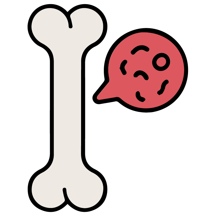 Monoclonal Gammopathy of Uncertain Significance (MGUS)