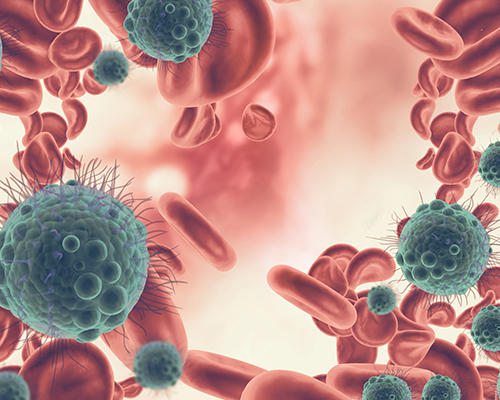 Myeloproliferative Neoplasm