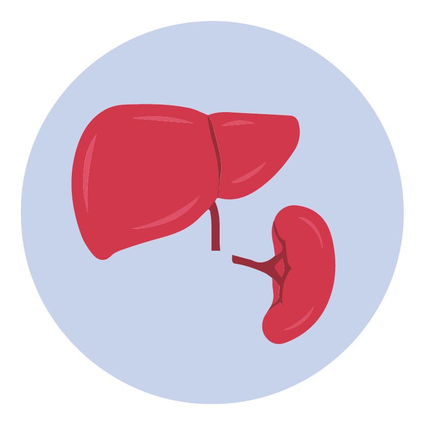 Enlarged Spleen (Splenomegaly) 