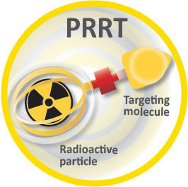 Peptide Receptor Radionuclide Therapy (PRRT)